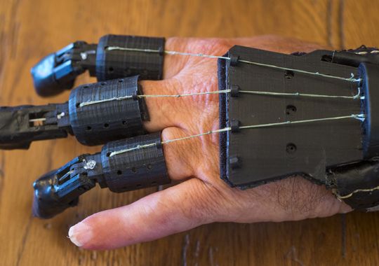 Man creates DIY prosthetic device after amputation