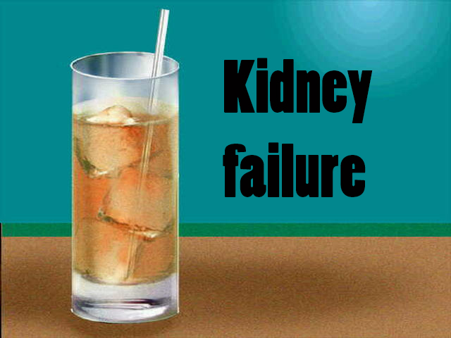 too-much-iced-tea-caused-man-s-kidney-failure-abc10