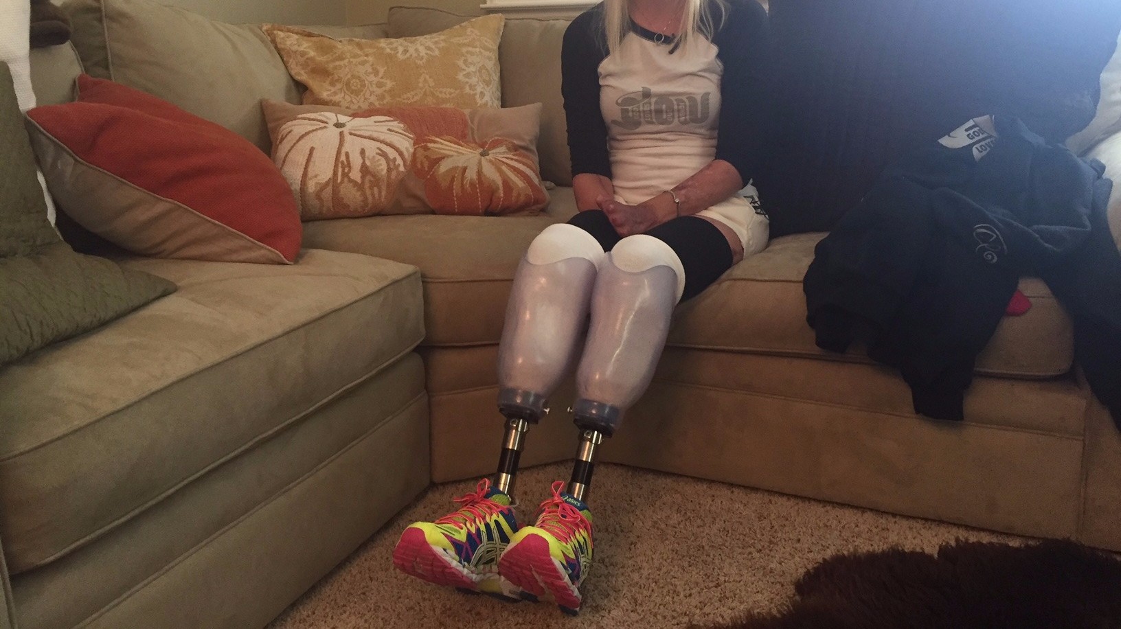 Amputee Gets Prosthetic Legs From Community S Support Newsnow