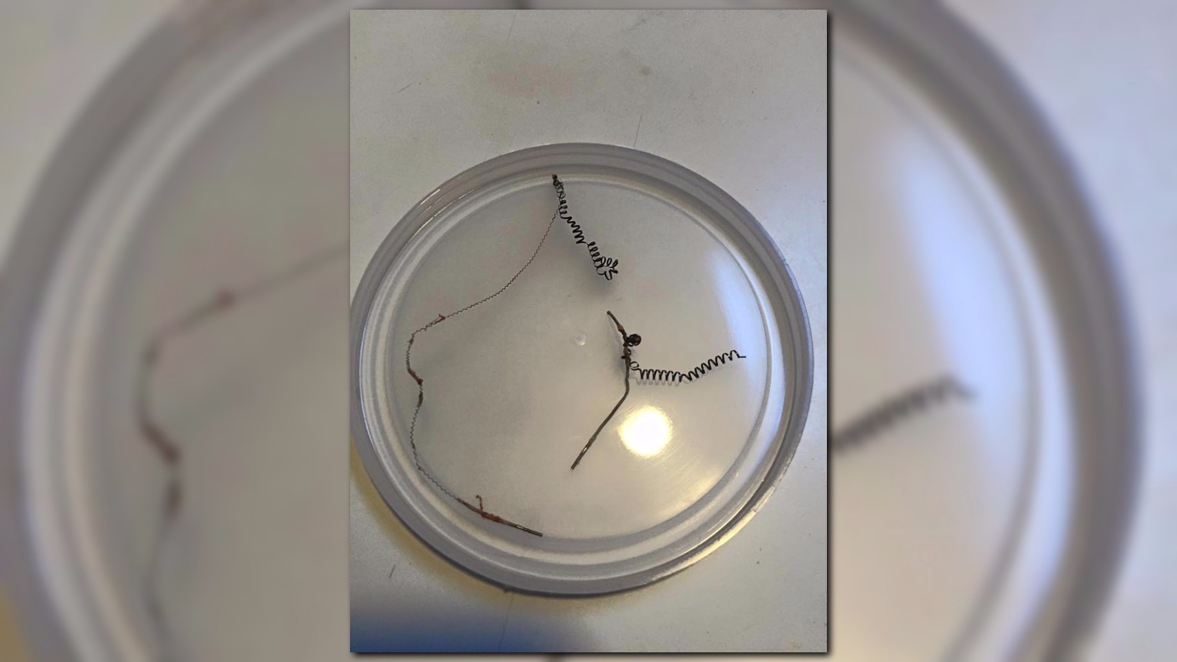 Lawsuit: Essure didn't warn women of...
