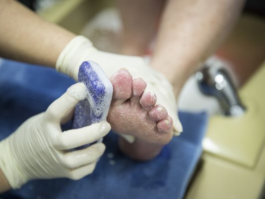 Forbidden cheese cheese grater used on feet during pedicure